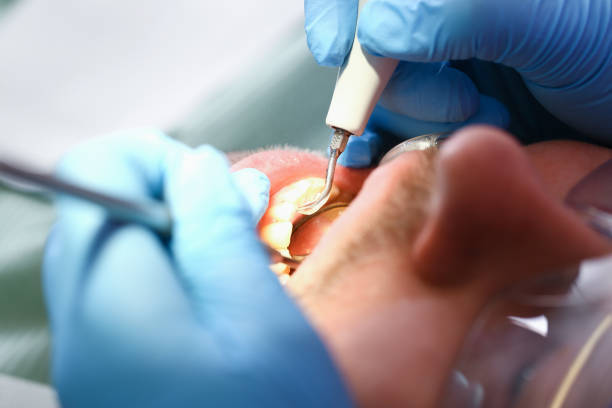 Best Emergency Dental Care for Trauma or Injury in Cotter, AR